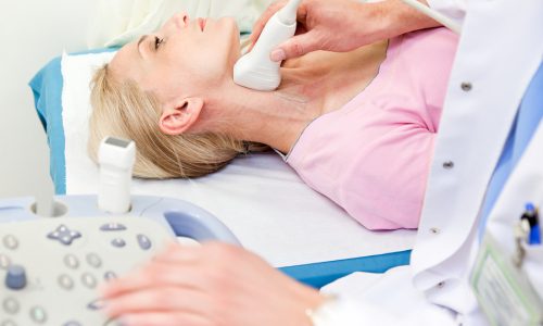 carotid Doppler ultrasound test evaluationt of arteries performed on female patient